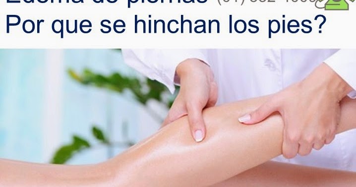 La vena en el pie el ejército