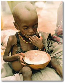 Gizi Buruk Penyakit Kurang Kalori Dan Protein Kkp Education Articles Gizi Buruk Penyakit Kurang Kalori Dan Protein Kkp Education Articles