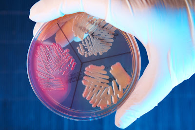 Artigos Científicos Bacteria+growing+on+a+Petri+plate+-+iStockphoto-+Monika+Wisniewska