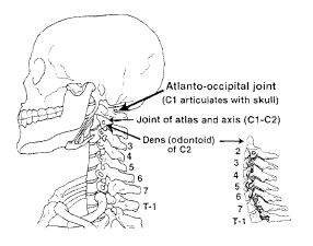 zebra hooves rotary subluxation of the atlanto occipital atlanto occipital joint