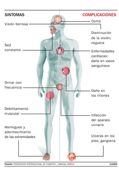 El dolor en los cuellos a la recepción de la comida