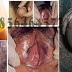 Daftar Obat di Apotik Untuk Kelamin Keluar Nanah thumbnail