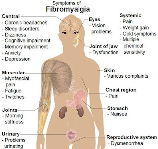 Fibromyalgia What is Fibro Fog?