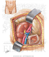 KIDNEY TRANSPLANTATION KIDNEY TRANSPLANTATION