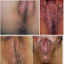 Obat AntiBiotik Ampuh atasi Sipilis Wanita thumbnail