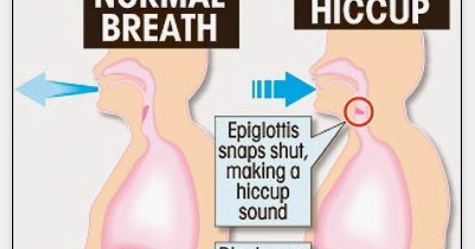 How To Not Hiccup After Eating Spicy Food How To Not Hiccup After Eating Spicy Food