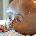 India: Bebe nasce com duas mentes!