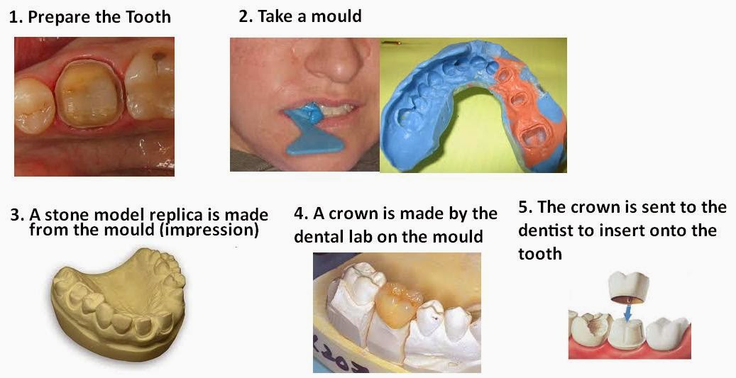 A Simple Dental Blog