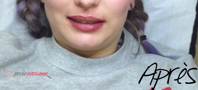 Maquillage permanent des lèvres : découvrez mon avant après