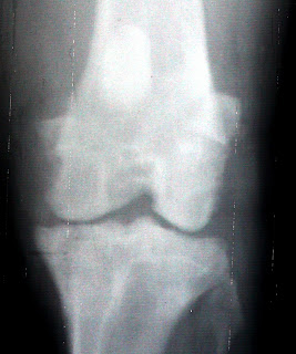 artrosis rodilla perro radio rodilla perro