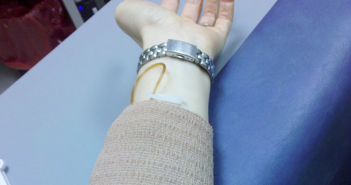 Hylan & Emily's Blog O' Life Iron Infusion IV Therapy My Story