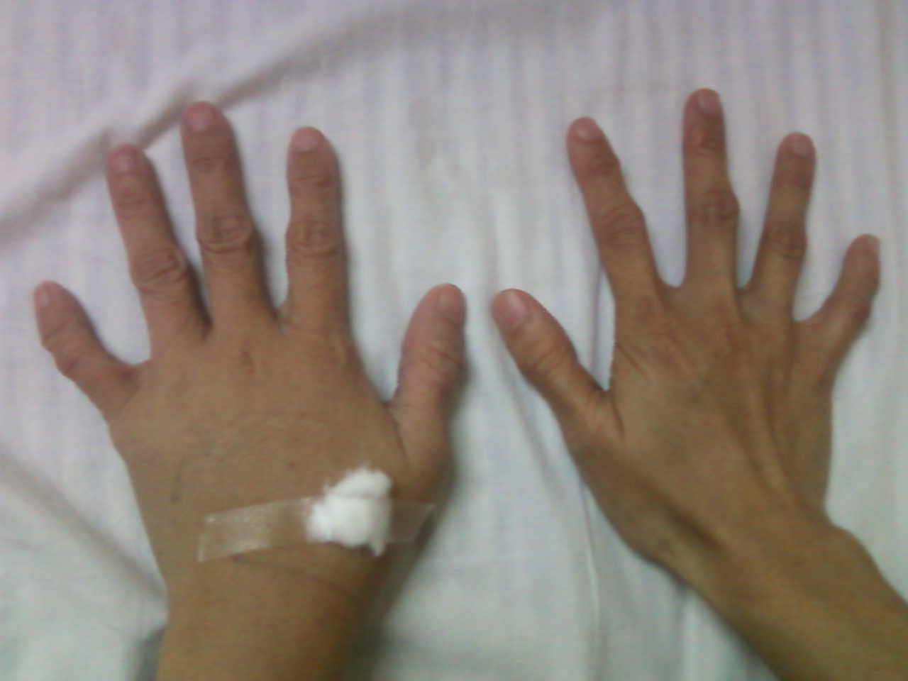 The Nurse's Notes Tuesday, RN WHEN A NURSE A PATIENT