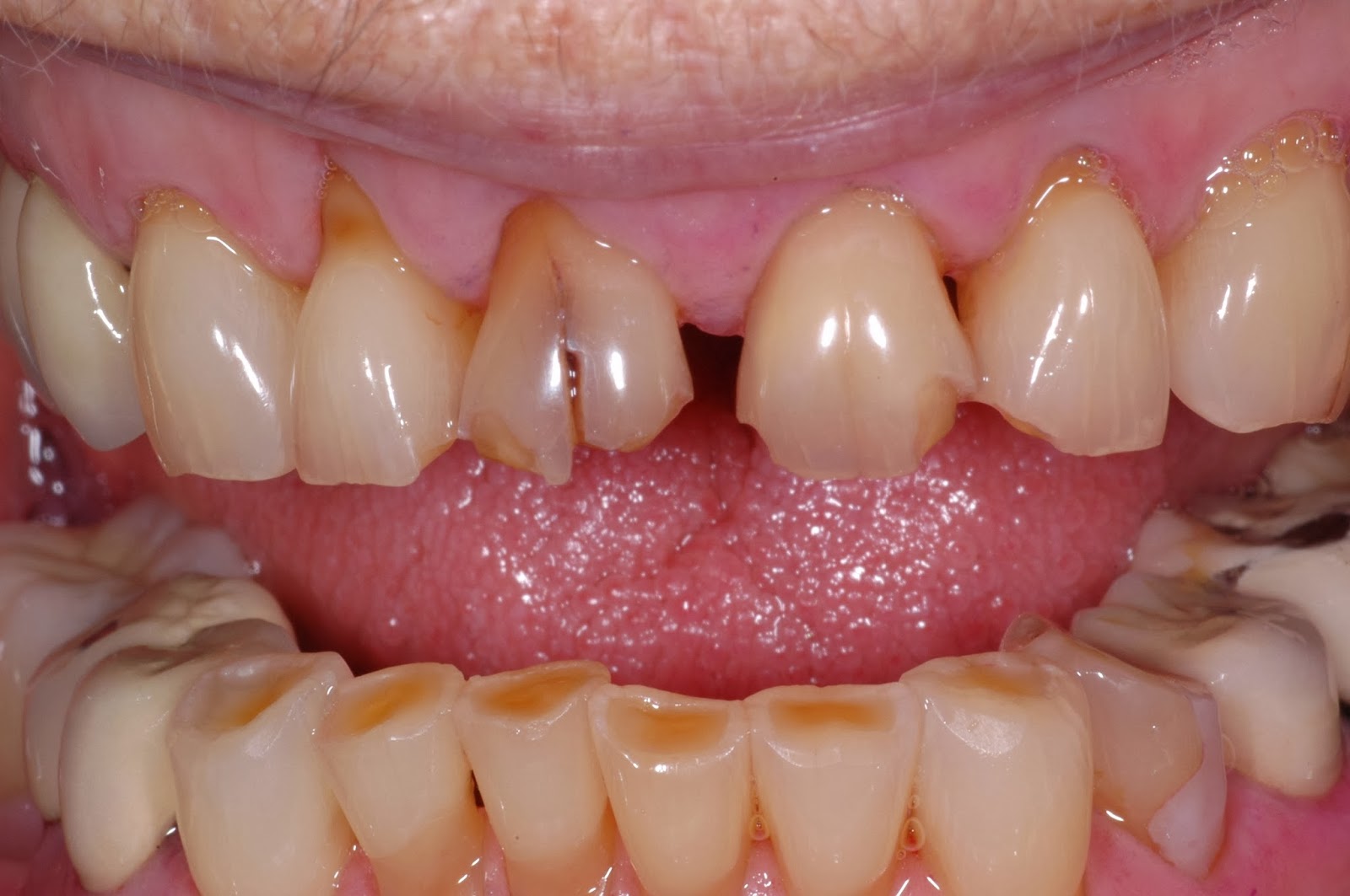 The Buzz from Your Favorite Dental Hygienists Attrition