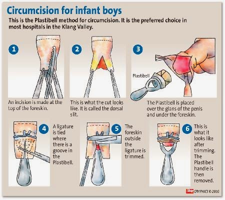 baby boy circumcised welcome been ve re