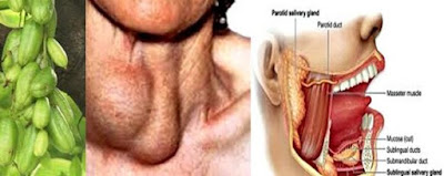 obat gondongan pada orang dewasa Gb. obat gondongan pada orang dewasa
