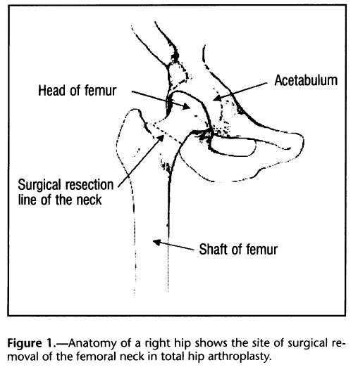 Fisioterapeuta Luís Miguel Brazão Gouveia Total Hip Arthroplasty