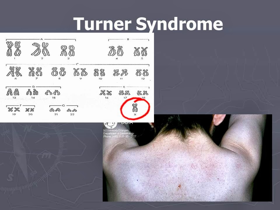 Slide 25