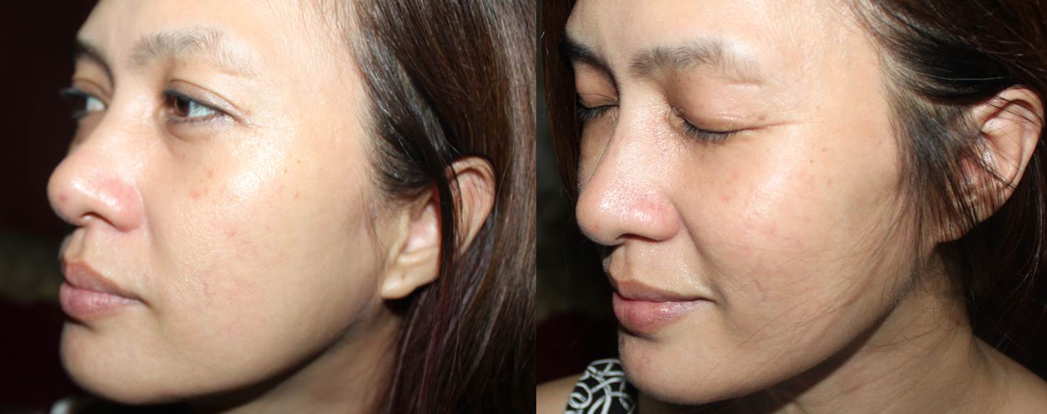 L'Oreal Paris Revitalift Laser 3x L'Oreal Paris Revitalift Laser 3x best skin care anti ageing anti wrinkle review swatch beauty nutrition
