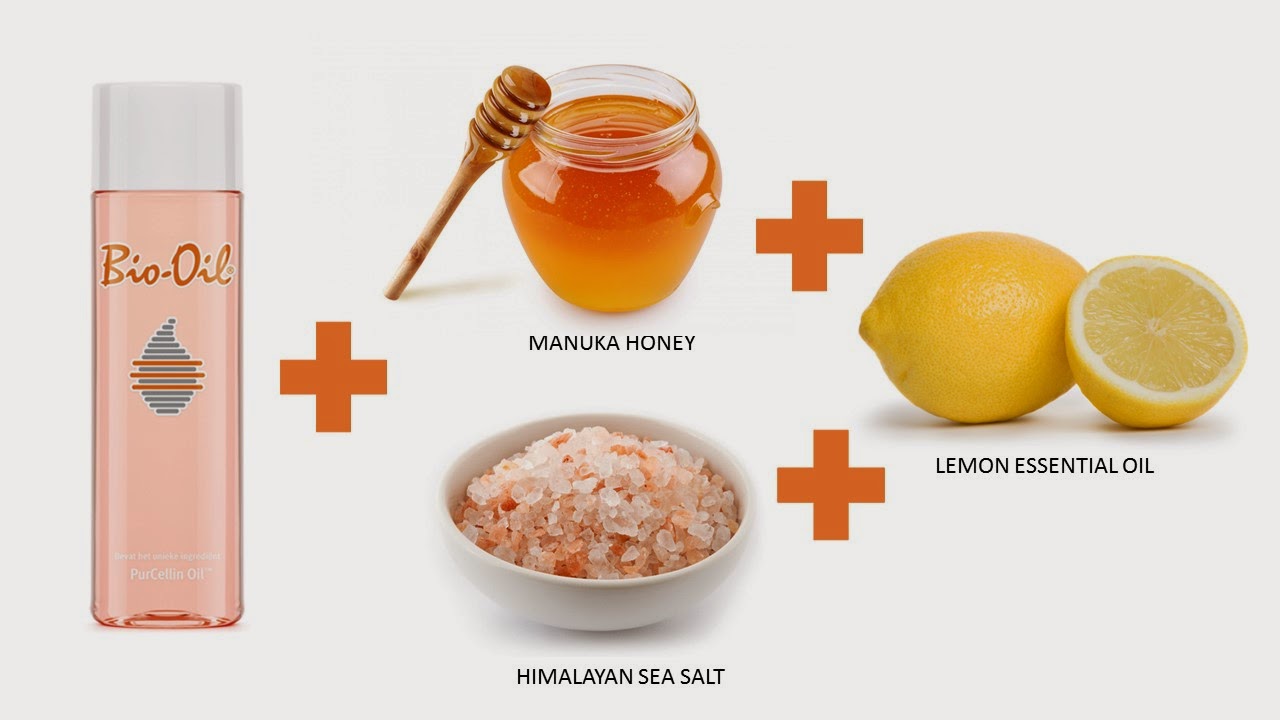 Reduce Scar Redness Natural Remedies Reduce Scar Redness Natural Remedies