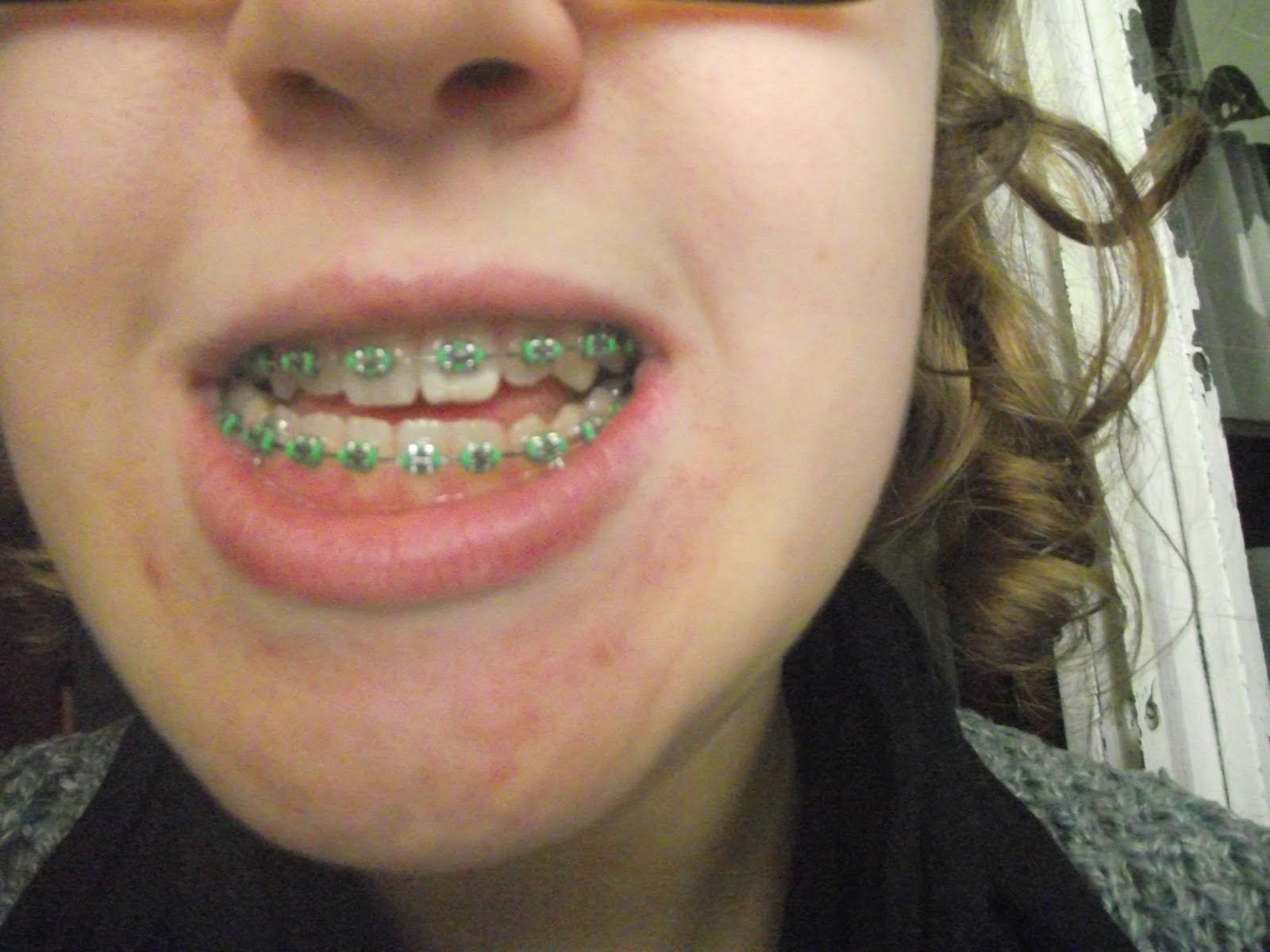 TehTeh Uncovered ® TEHTEH WITH BRACES Lime Green + UPDATE