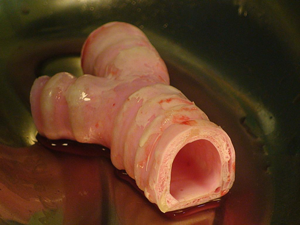 http://4.bp.blogspot.com/-QH4FAV2jLJ0/ThoRemboX2I/AAAAAAAAcFM/Sdl1WvSKsjA/s1600/patient-gets-worlds-first-artificial-trachea-kf77fs5-x-extralarge.jpg