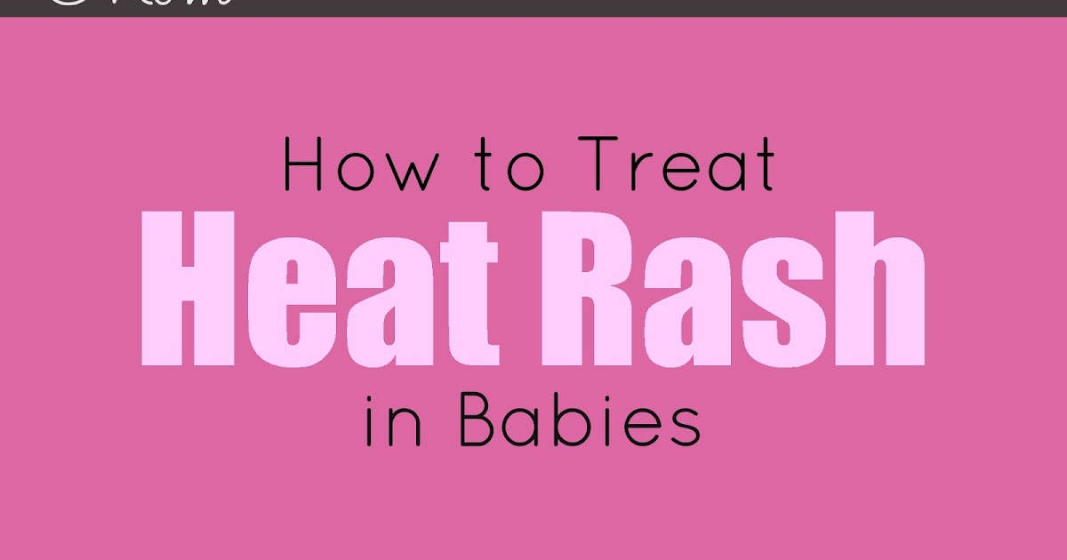 Mom Heat Rash What It Is and How to Treat It