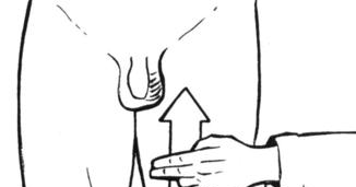 How to elicit the Cremasteric Reflex?
