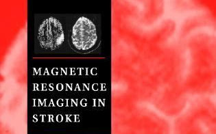 Hình ảnh Cộng hưởng từ MRI trong Đột Qụy