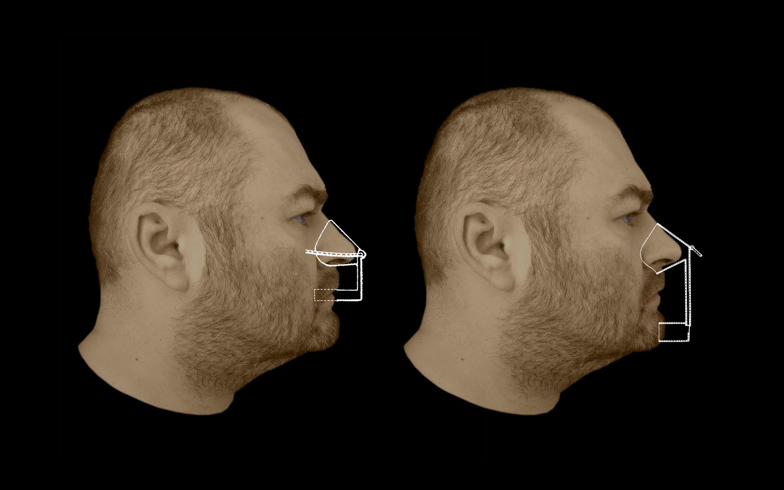 Historic Nose Flutes The Nasalette Template