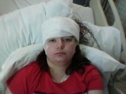 During rehab she had an EEG completed to watch for seziures