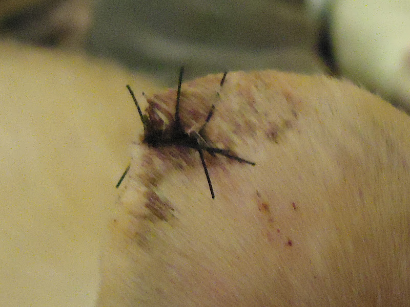 Close up picture of the 4 stitches that were put in the tip of Brandon title=