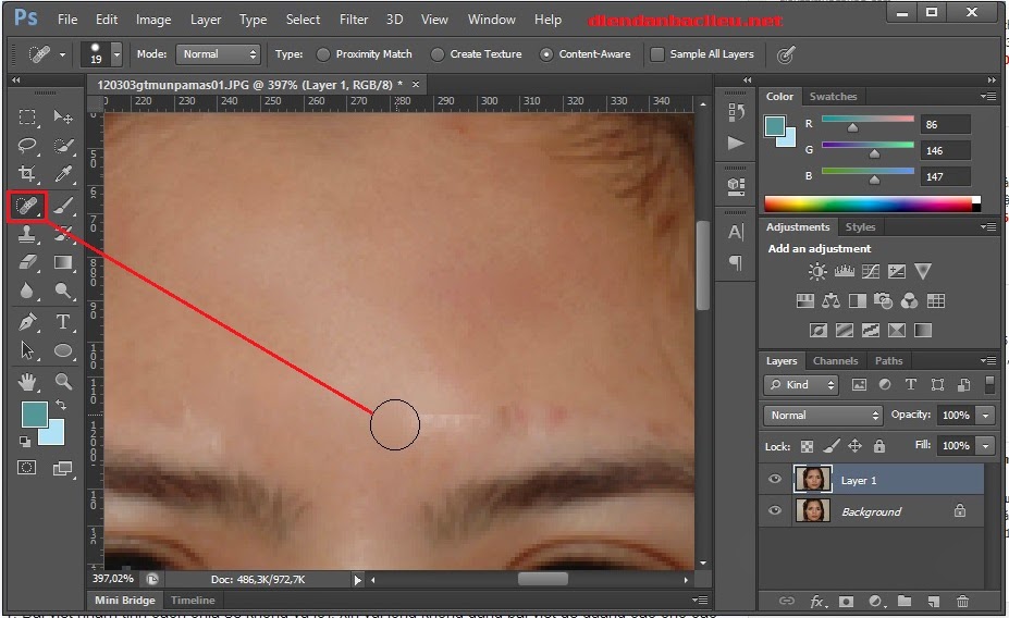 xoa-mun-photoshop xoa-mun-photoshop
