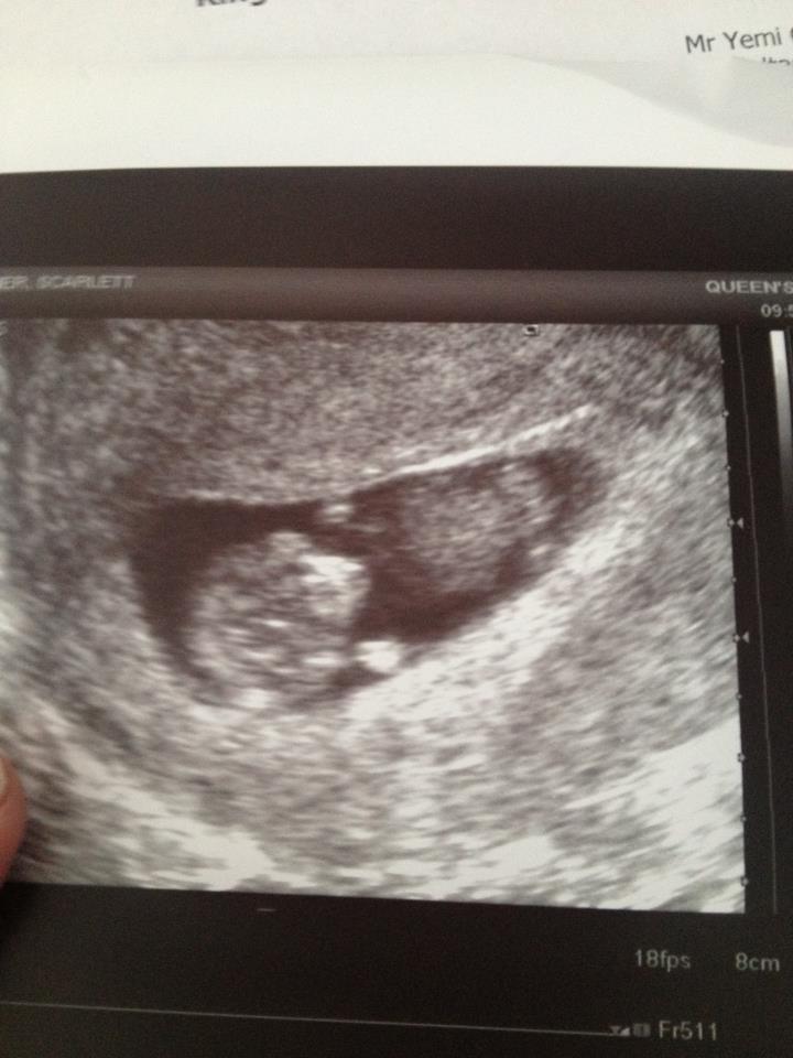 Bumps Mummy 15 Weeks Pregnant Update.....