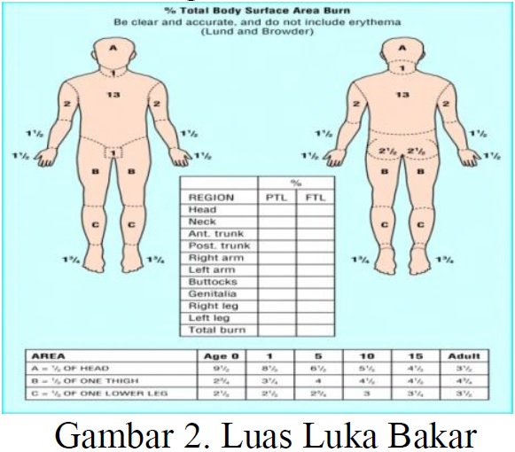 LUKA BAKAR Pena Medis