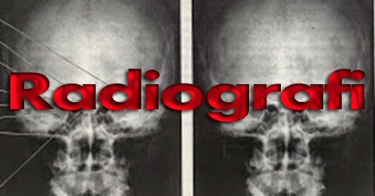 Pembentukan Gambar Radiografi