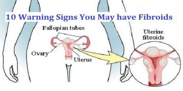 10 Warning Signs You May have Fibroids fibroids