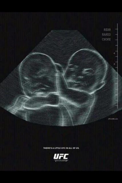http://foto-kamu.blogspot.com Tertangkap USG anak kembar dalam kandungan berantem