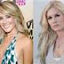 Heidi Montag Before and After thumbnail