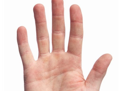 Más eficaz el ungüento de la psoriasis