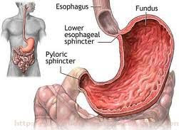 ulcer ulcer