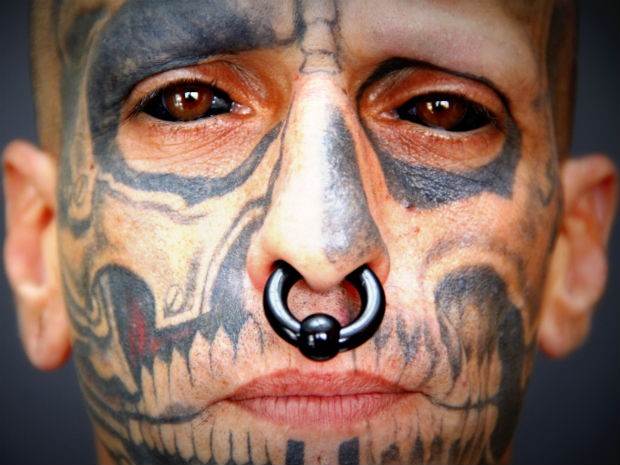 Tattoo Treatment Tattoo Treatment