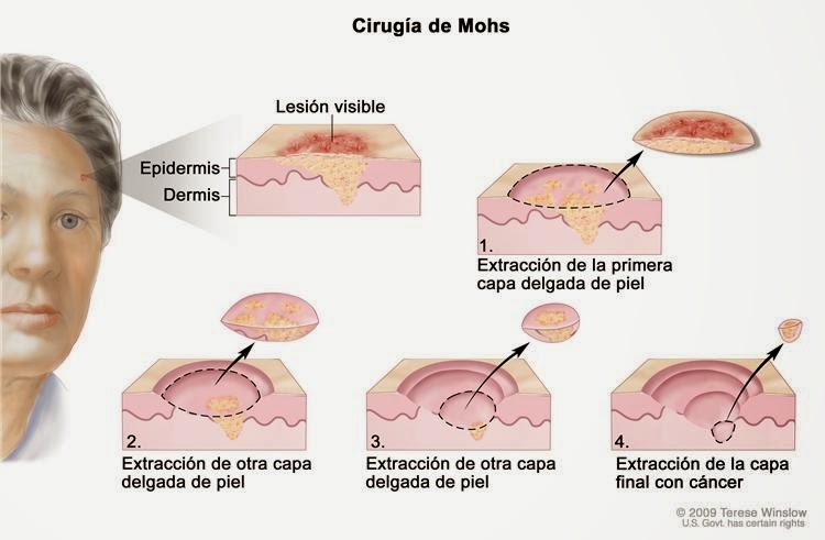 El ajuste de la persona armirovaniem