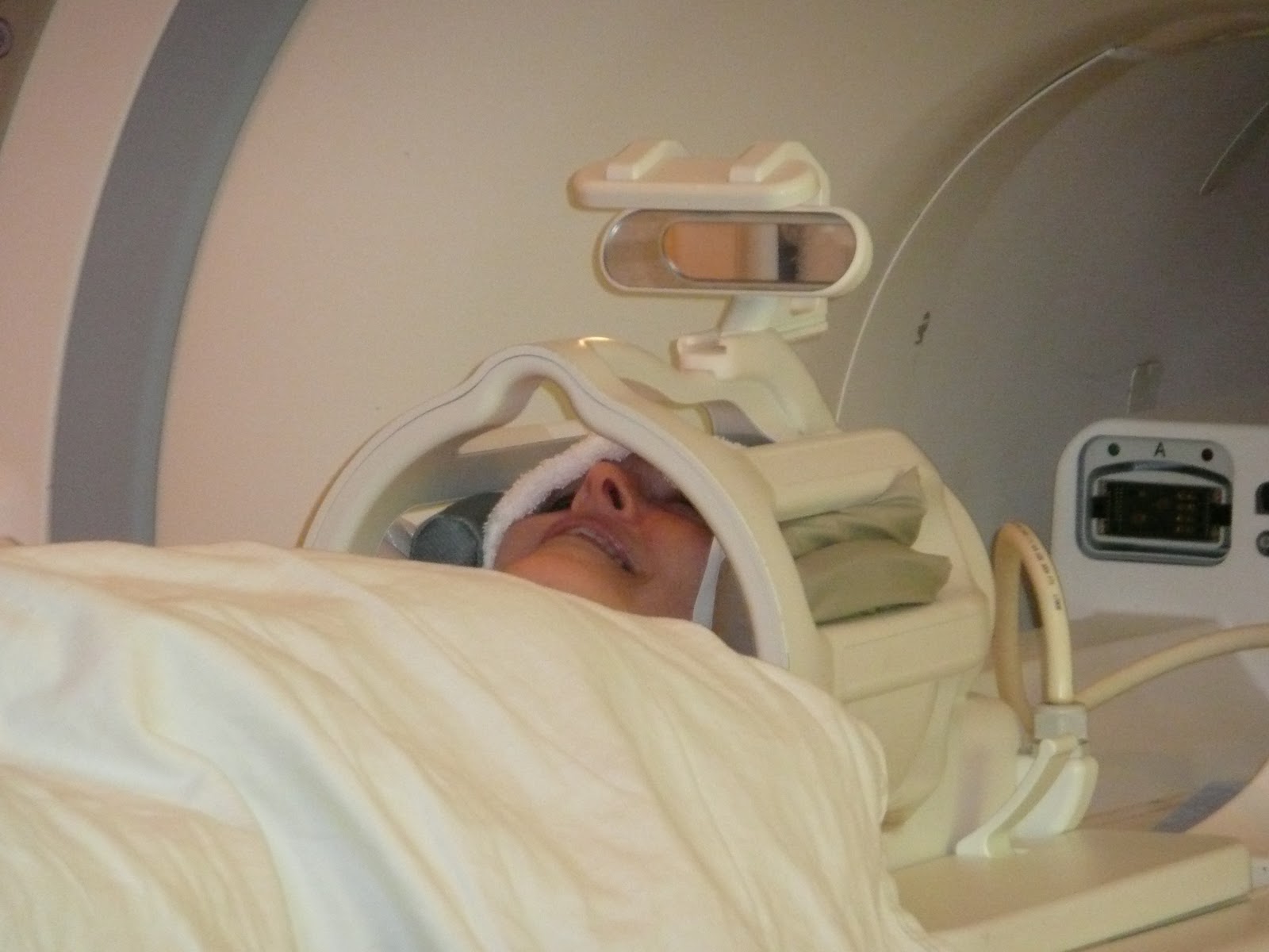 My Journey - Orbital MALT Lymphoma: Making the Radiation Mask