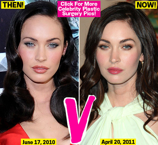 Funny Picture Celebrity Megan Fox Eye Plastic Surgery