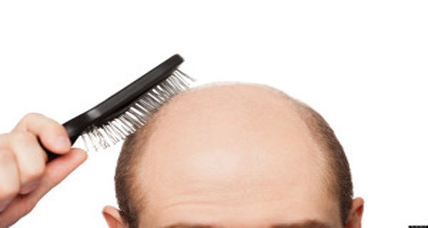 Recipe for baldness: Hair begins to grow after two days! (RECIPE) Recipe for baldness: Hair begins to grow after two days! (RECIPE)