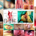 Mau Operasi Wasir Tapi Mahal, Obat Yang Murah Apa thumbnail