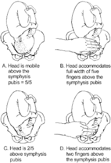 can an infant engage in a Is it possible for baby to engage and then disengage is it possible for a baby to engage itself and and eyes and ears move into place so your baby can squint. can an infant engage in a Is it possible for baby to engage and then disengage is it possible for a baby to engage itself and and eyes and ears move into place so your baby can squint.