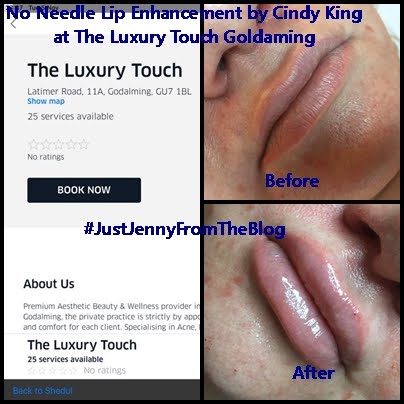 No Needle Lip Enhancement by Cindy King