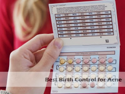 Best birth control options for acne