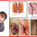 Obat Tradisional BAB Berdarah Ampuh thumbnail